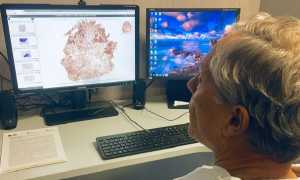 Digital Pathology immagine hi res