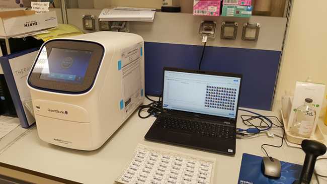 apparecchio analisi biella